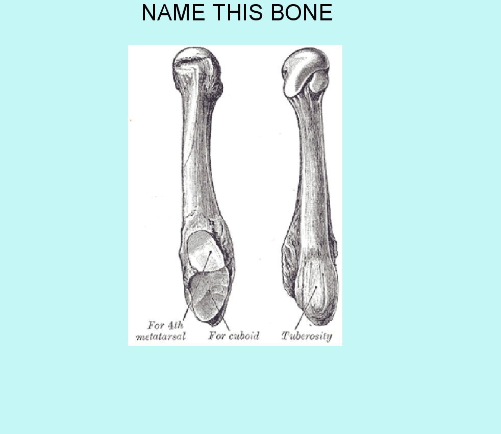 metatarsal5q_img.gif